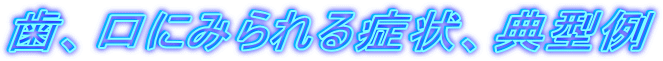 ���A���ɂ݂���Ǐ�A�T�^��